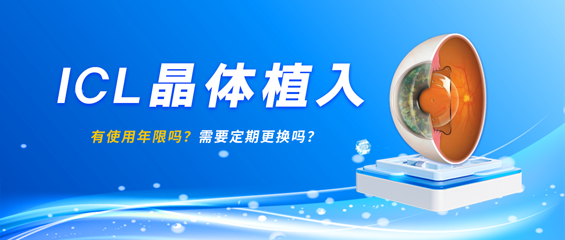 ICL晶体植入有使用年限吗？需要定期更换吗？